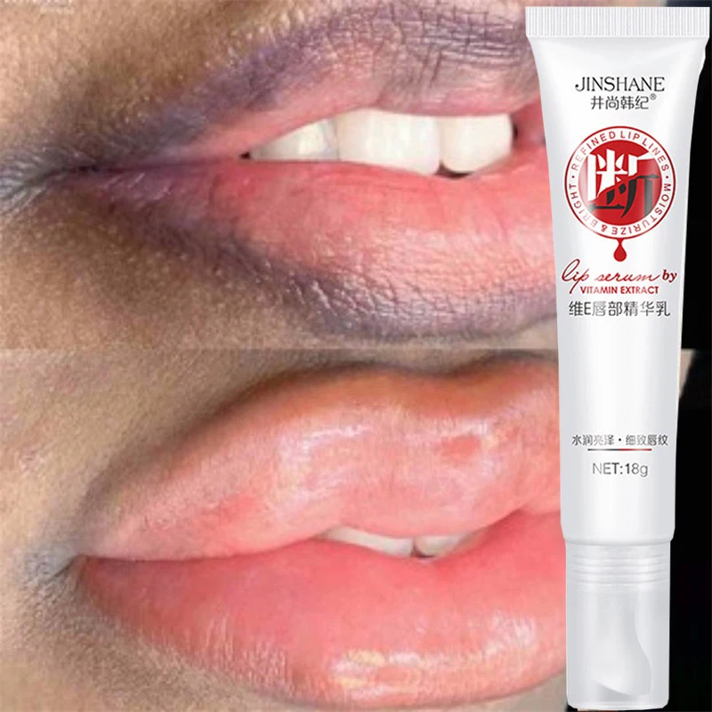 Remove Dark Smoke Lips Pink Fresh Lightening Bleaching Cream Treatment Lip Balm Whitening Moisturizer Nourishing Essence Lips