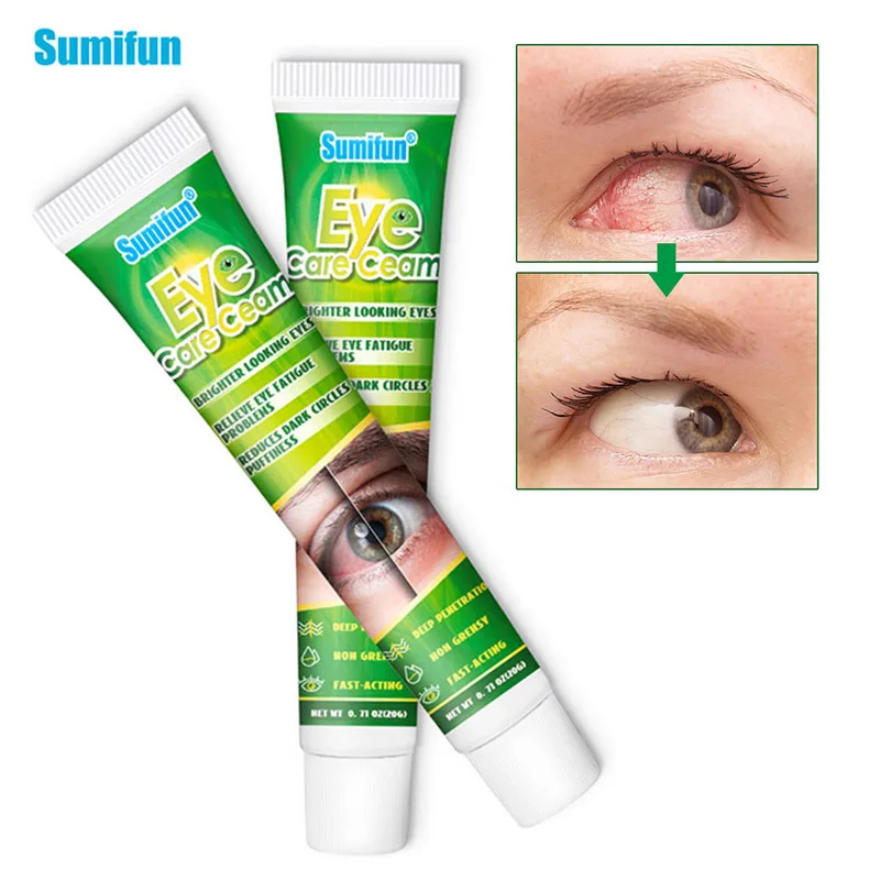 Sumifun 20g Relieves Eyeball Fatigue/Dry / Itching Red Eyes Remove Eyes Red Blood Moisturizing Improve Eyesight Removing Eye Bag