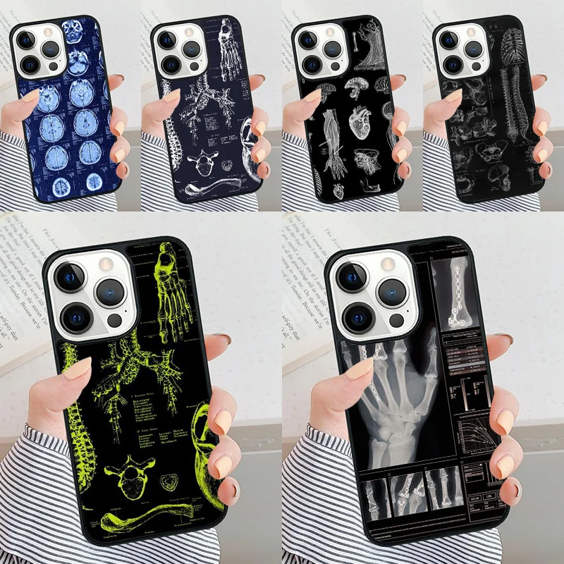 Radiological Human Organs Skeleton Phone Case for iPhone 16 15 SE2020 6 7 8 Plus for Apple 13 11 12 14 Mini Pro Max Cover