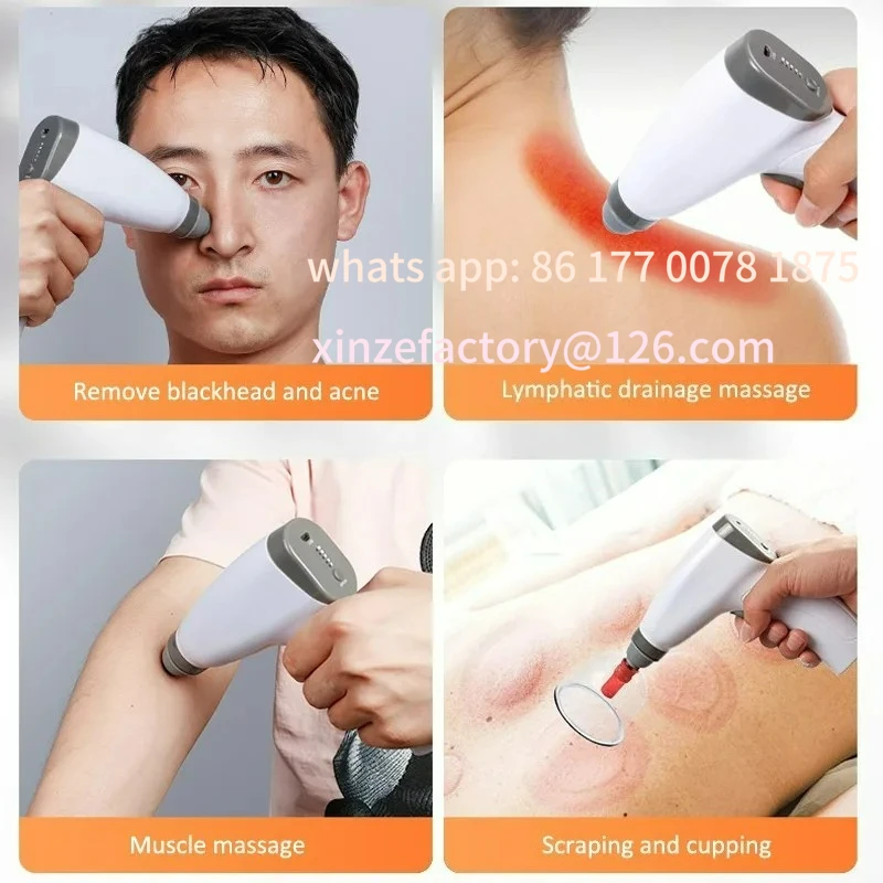 Customizable Elektrische Cupping Pistool Negatieve Druk Cupping Pomp Usb Opladen Chinese Massage Tool