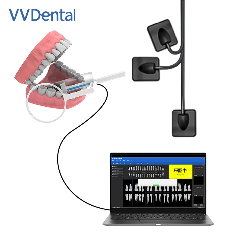 Dental Portable Sensor X-Ray Digital Sensor for Intraoral Imaging System HD Image Radiovisiograph Dentistry Tools Sensor