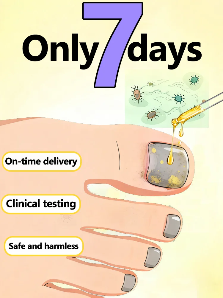 

Вы benefit, а цена очень доступна. Блокировка грибных инфекций и лечение uickly.