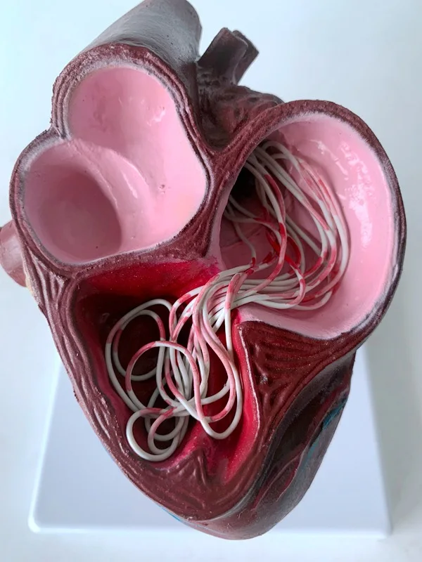 Medical Science Dog heart Pathology model Canine heart  Dog Heartworm Anatomical Model