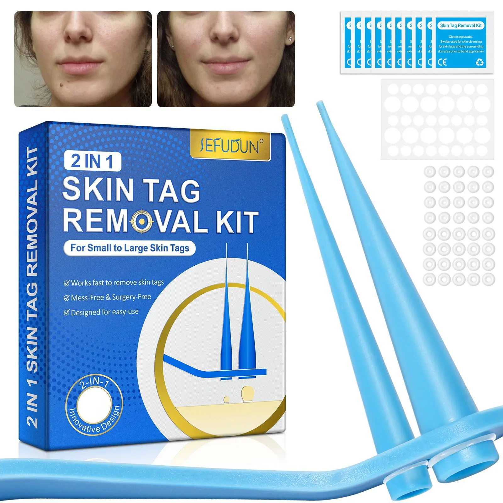 2 In 1 Auto Skin Tag Removal Kit Painless Mole Wart Remover Equipment Micro Skin Tag Treatment Tool Easy To Clean Skin Care Tool