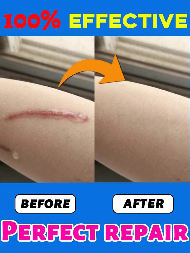 Zorg voor je littekens en laat het ze helpen oplossen