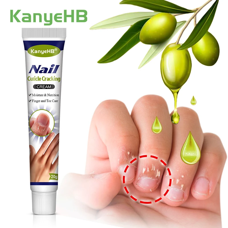 

1pcs Finger Keratin Cream Improve Dry Skin Reduce Keratin Moisturize Nails Finger Moisturizing Cream Mild Plant Ingredients G055