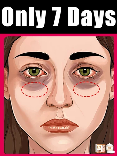 Venta de crema para ojos eliminadora de arrugas, bolsas para ojos, ojeras, antihinchazón, reafirmante, iluminador, líneas finas, herramienta hidratante