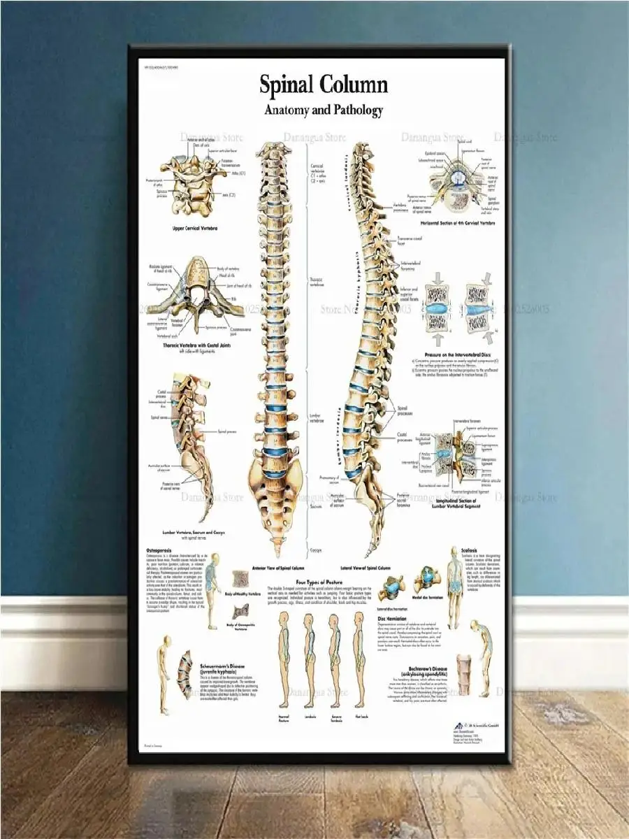 Foot Reflexology Trigger Points Anatomy Chart  Canvas Wall Art Poster for Study  Home Decor