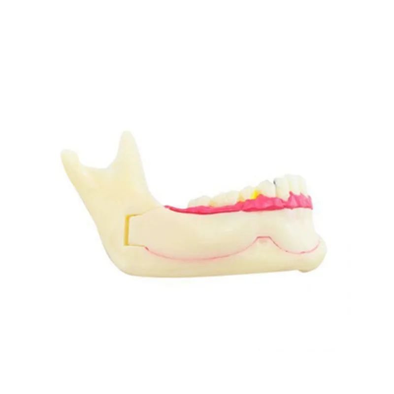 Dental Endodontic Treatment Model Mandible Tissue Anatomical Model Anatomy of Gums Dentistry Study Oral Care Teach Teeth Model