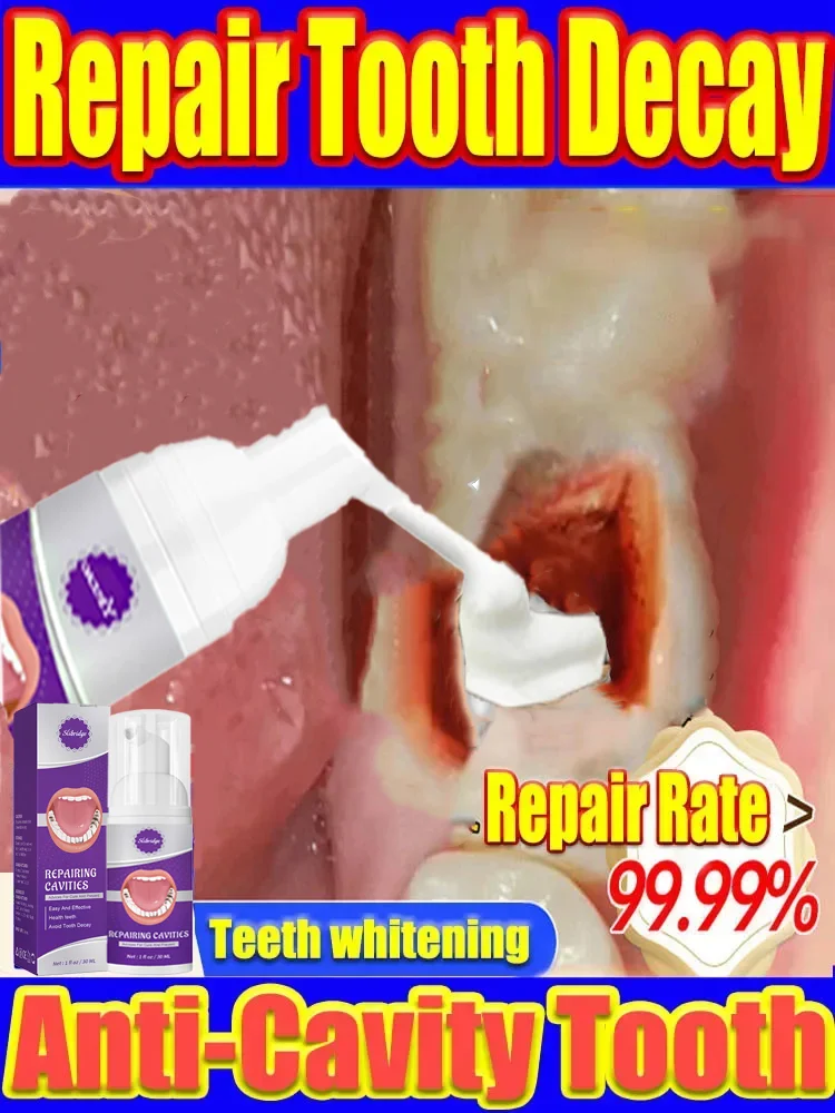 

Decay tooth cavities healing anti caries