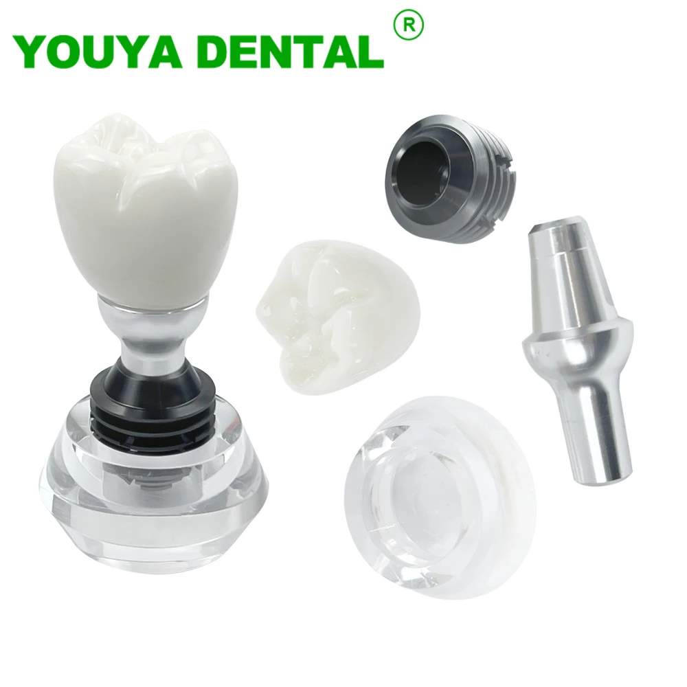 

Dental Teeth Model Crystal Implant Typodont Detachable Single Tooth Crown Base Dentistry Teaching Study Demonstration Models