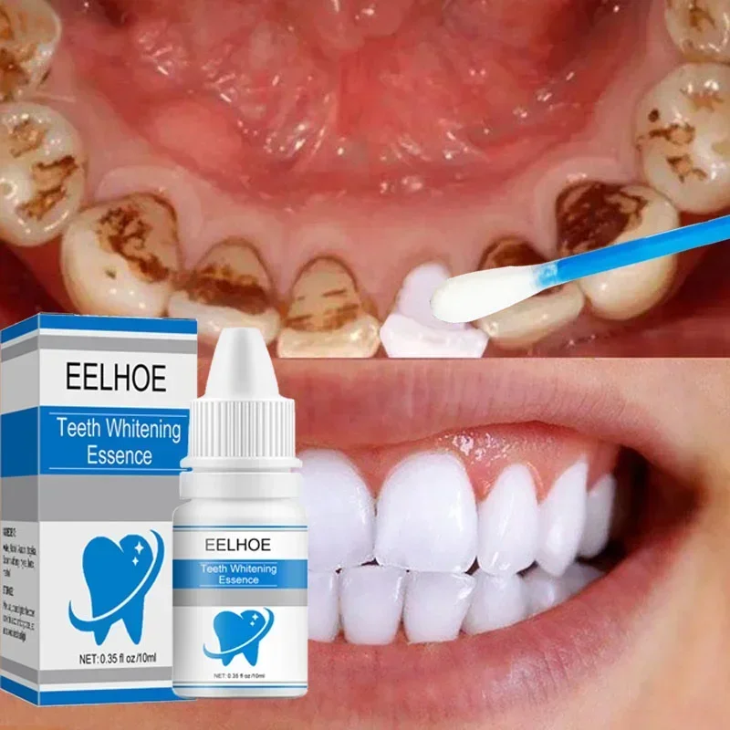 EELHOE-Essência Clareador Dentes, Remover manchas de placa, Higiene Oral, Produtos Branqueadores, Limpeza, Hálito Fresco, Ferramentas de Odontologia