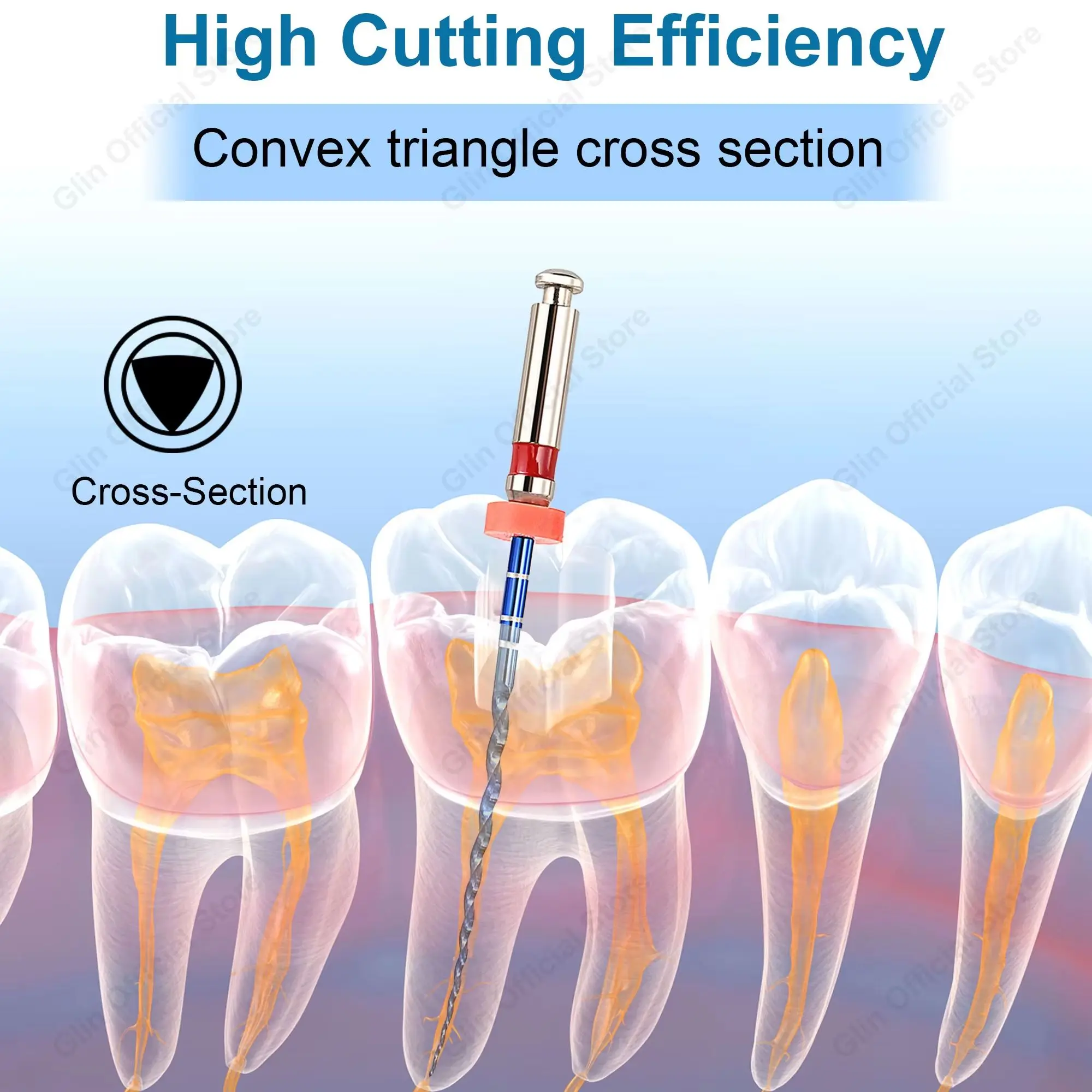 Glin Dental Files Dental Rotary 02 04 06 Taper Endo Files Endodontic Files Use for Root Canal Cleaning Heat Activation