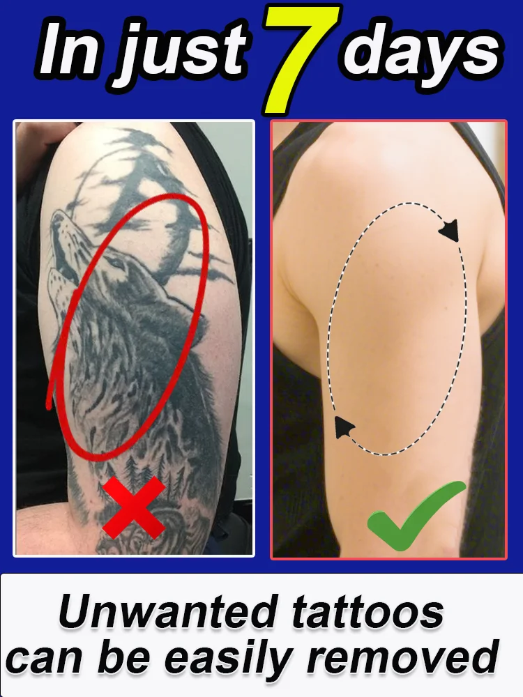 

Remove tattoos, no side effects, remove black color tattoos deep cleansing