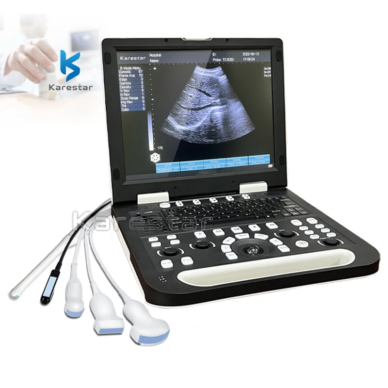 

Karestar K-H300 Portable Laptop Ultrasound color Veterinary Ultrasound Machine