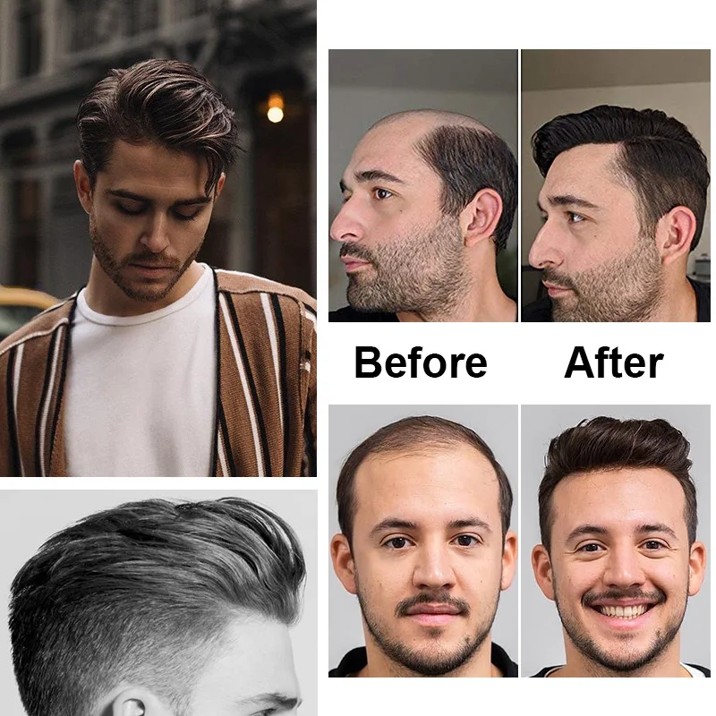 Antimikrobielles Vstyle Herren-Toupet Dünne Haut Vollständig PU 0,08-0,12cm V-Loop Frontperücke Echthaar-Perücken für Männer Unsichtbare Natürliche Haarlinie – Detail 15