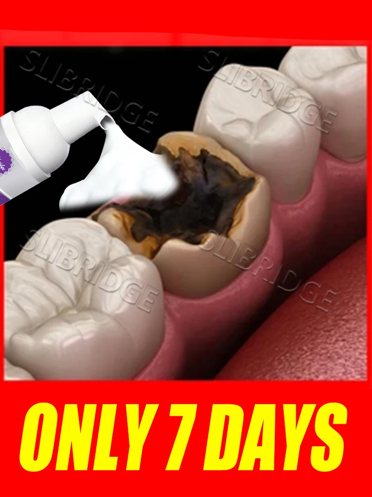 2025 Intraorale verzorgingstools Mousse mondwasinstrument geschikt voor alle leeftijden, promotionele korting