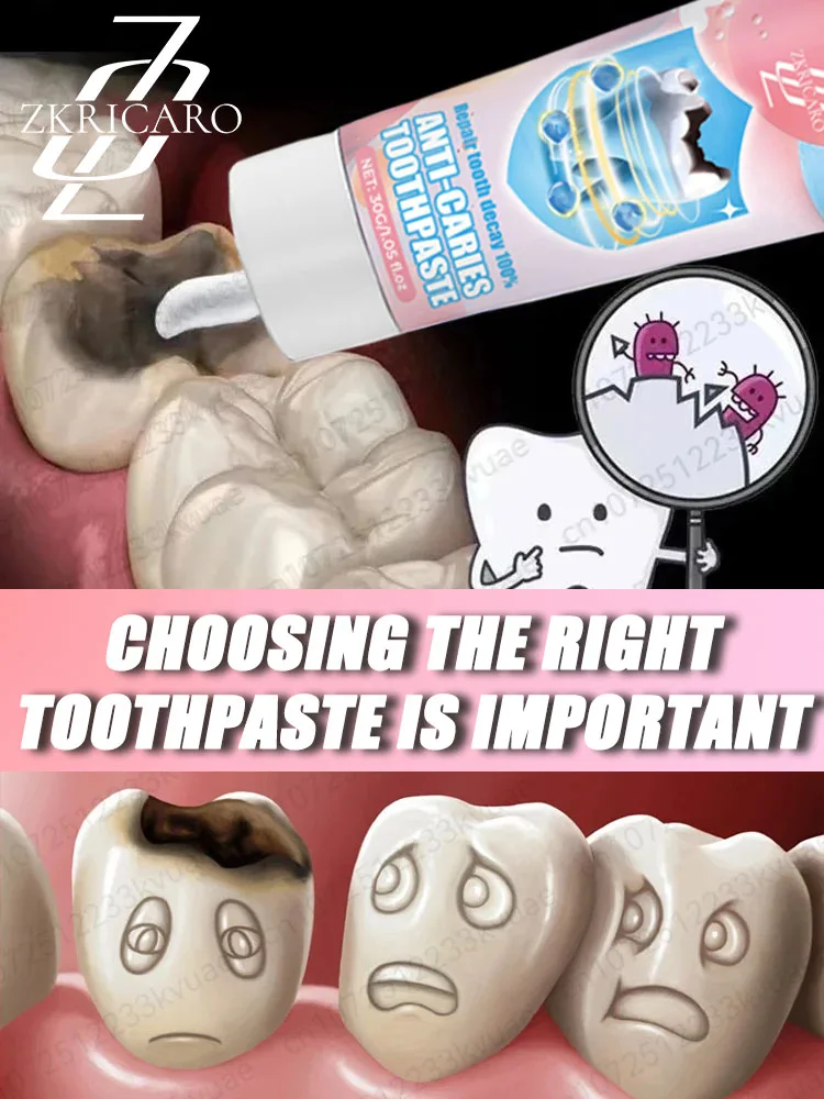 Anti-Cavity Toothpaste Tooth Remineralization Recovery Enamel Repair Strengthening Restoration Decay Protection Dental Teeth