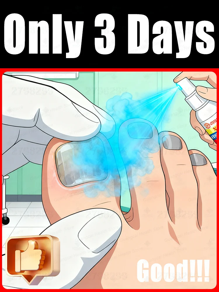 

When nails turn yellow, thicken, or fall off, ᵘˢᵉ ⁱᵗ ᵗᵒ ˢᵗᵉʳⁱˡⁱᶻᵉ ᵃⁿᵈ ᵖʳᵒᵗᵉᶜᵗ ᵗʰᵉᵐ ᵃˢ ˢᵒᵒⁿ