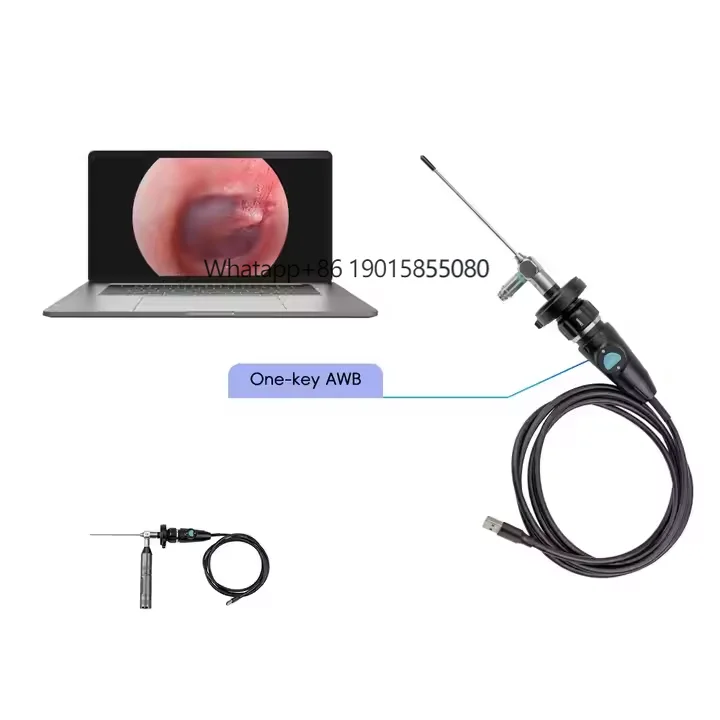 

Medical Portable USB Full HD 1080P ENT Endoscope for ENT Laparoscopic Gynecology Rigid Endoscope