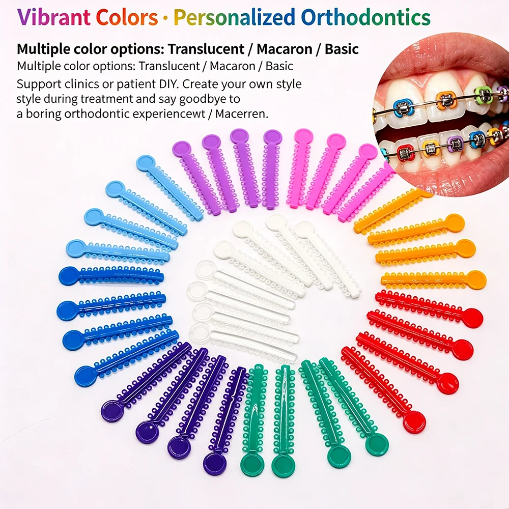 Multi-color orthodontic elastic O-ring rubber bands, multi-color dental ligature elastic rubber bands, orthodontic ligature ring set - O-ring dental ligature rings for orthodontic treatment and braces, 48 colors available, 40 pieces