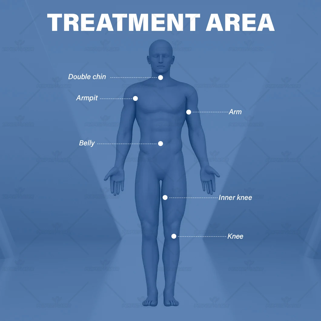 Perfectlaser-Machine de cryolipolyse, perte de graisse, corps saillant, surpoids sanguin, pression négative, refroidissement, dispositif de réduction de la cellulite