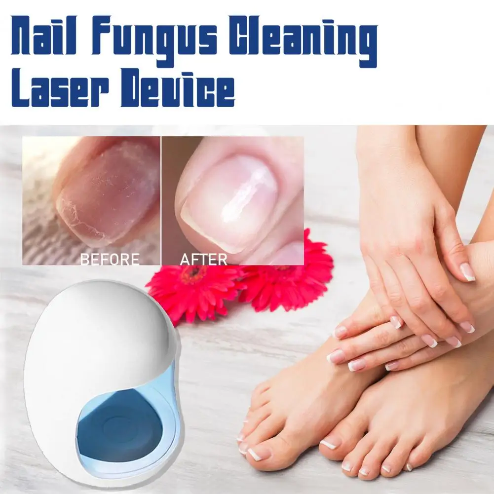 Nail Fungus Laser Blue Light Therapy Nail Fungus Device Infrared Cold Lasers Nail Care Device Toenail Fingernail Treatment