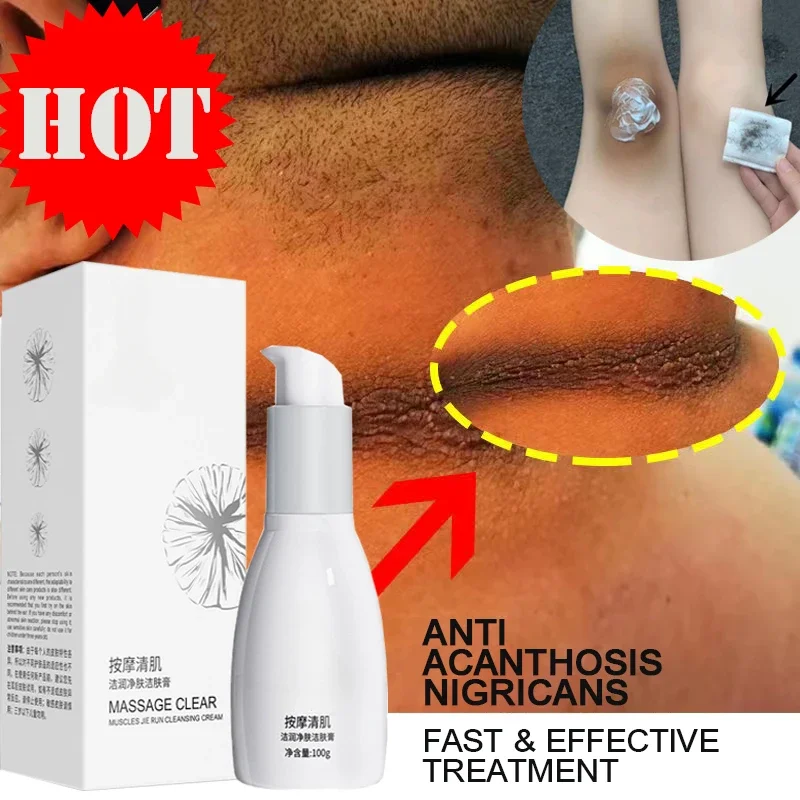 Whitening Cream for Private Parts Remove Melanin Pigmentation Fast Knuckle Elbows Stains Remover Serum Anti Acanthosis Nigrican