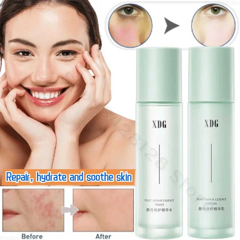 XDG Yeast Repair Essence Water Emulsion Hydrating Moisturizing Oil Control Refreshing Astringent Pores Repair Barrier