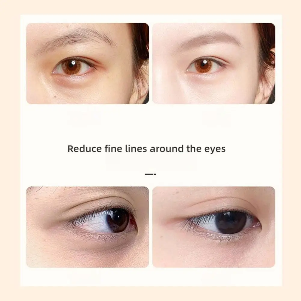 VC Lutein العين جوهر النفط العين الرول الكرة يزيل الهالات السوداء مملة ممحاة حقيبة العين تتلاشى غرامة خط جوهر العين المغذي #6