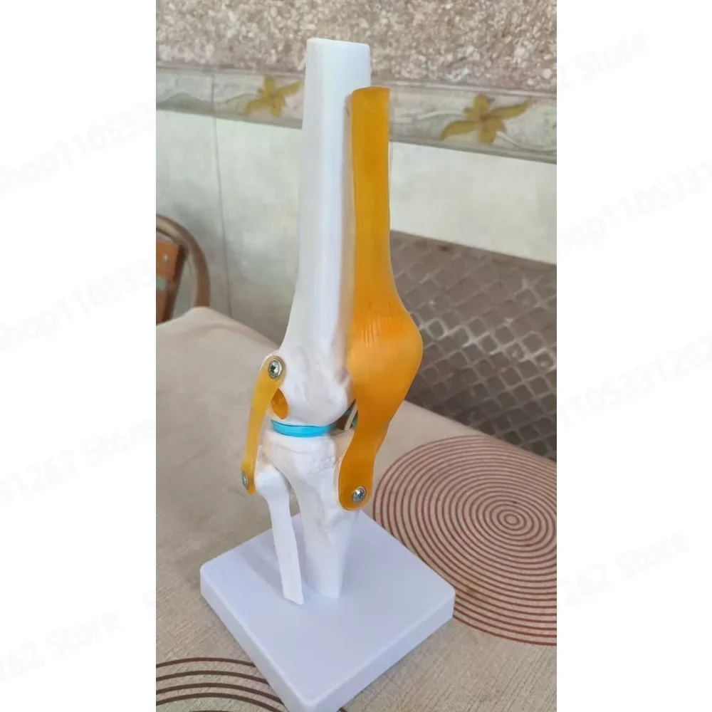 Human Knee Joint Functional Model, Meniscus Cruciate Ligament Movable Kneecap Patella Teaching Skeleton Model