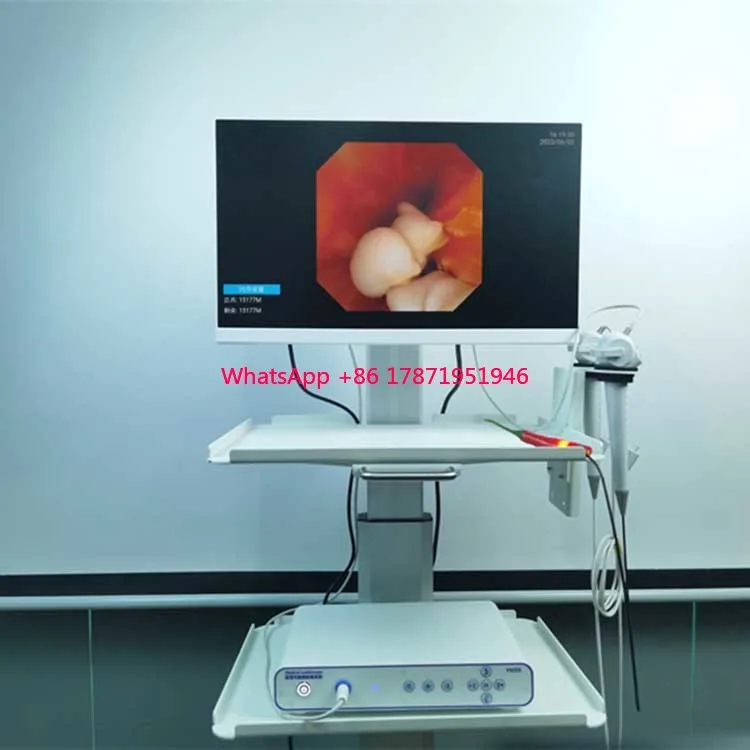 2024 new disposable flexible ureteroscope portable HD endoscope image processor