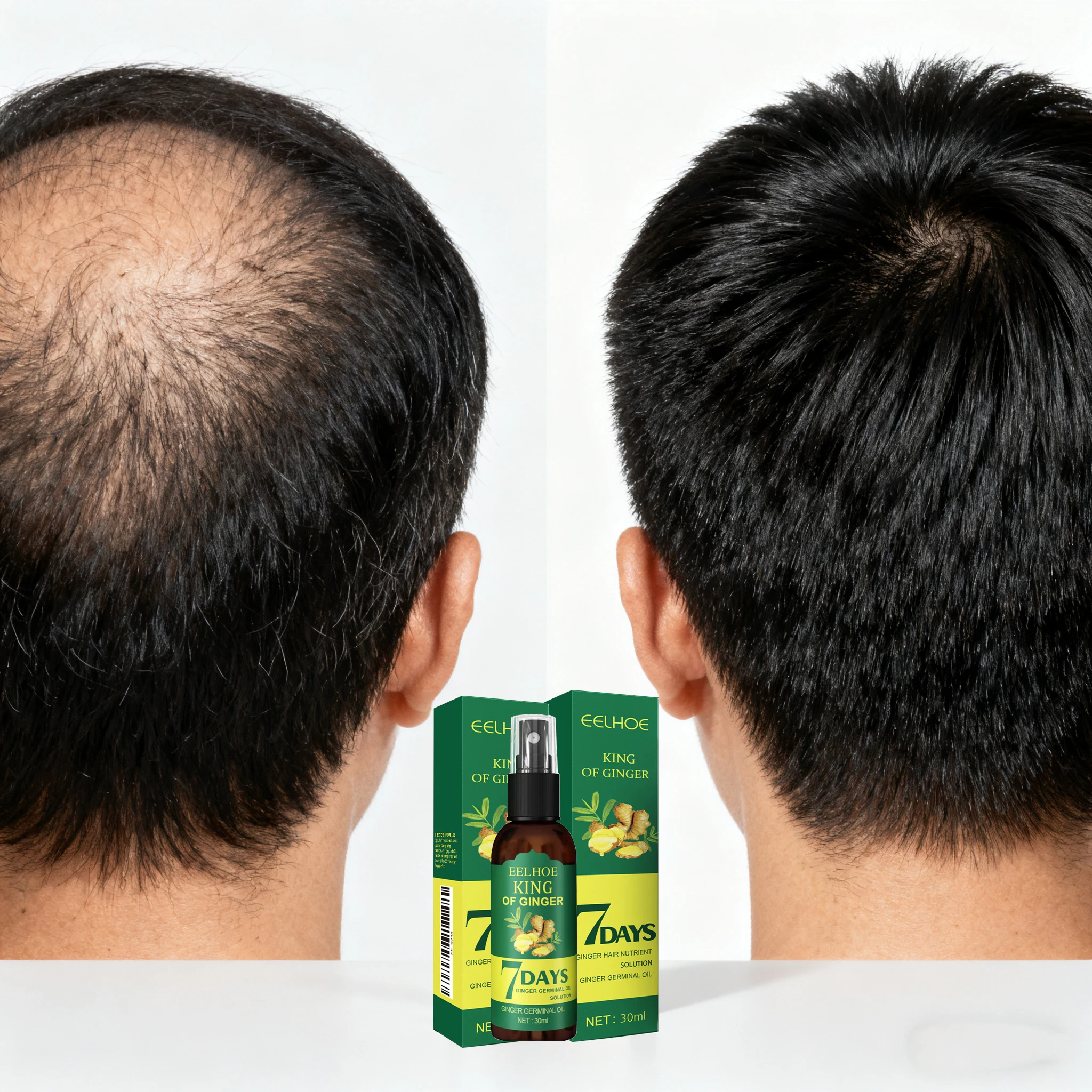 

Anti Hair loss Baldness Regrowth Hair Care Oil Repair Damaged Scalp Treatment For Women Men Preventing Hair Loss Ginger Serum