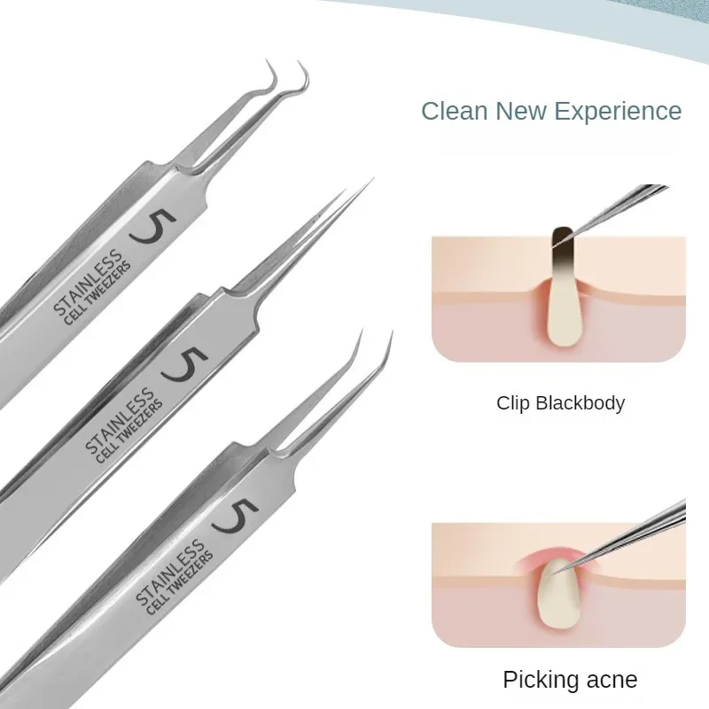 スキンケア用のにきびピンセット,顔の美しさ,にきびの除去,針ツール,極細,No。5,携帯電話,1パック