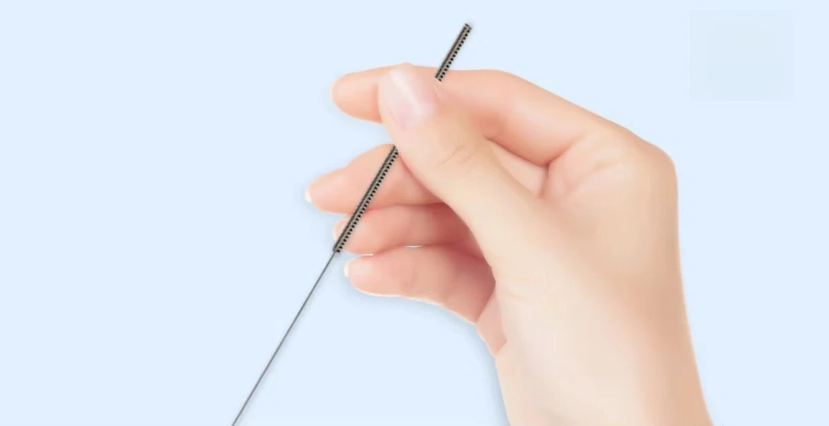Durable Steel Handle Acupuncture Moxibustion , Medical Professional Acupuncture Therapy