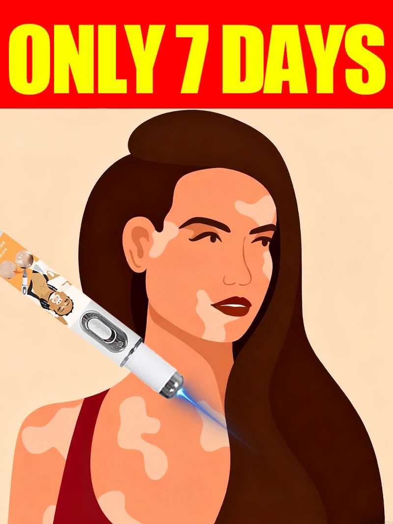 

Hot selling blue light pen to solve body vitiligo, vitiligo care tool