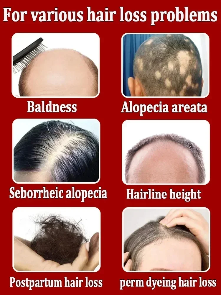 Óleo essencial para o crescimento do cabelo, tratamento nutritivo para as Pontas Dividas e cabelos secos Organics, hortelã, nutritivo