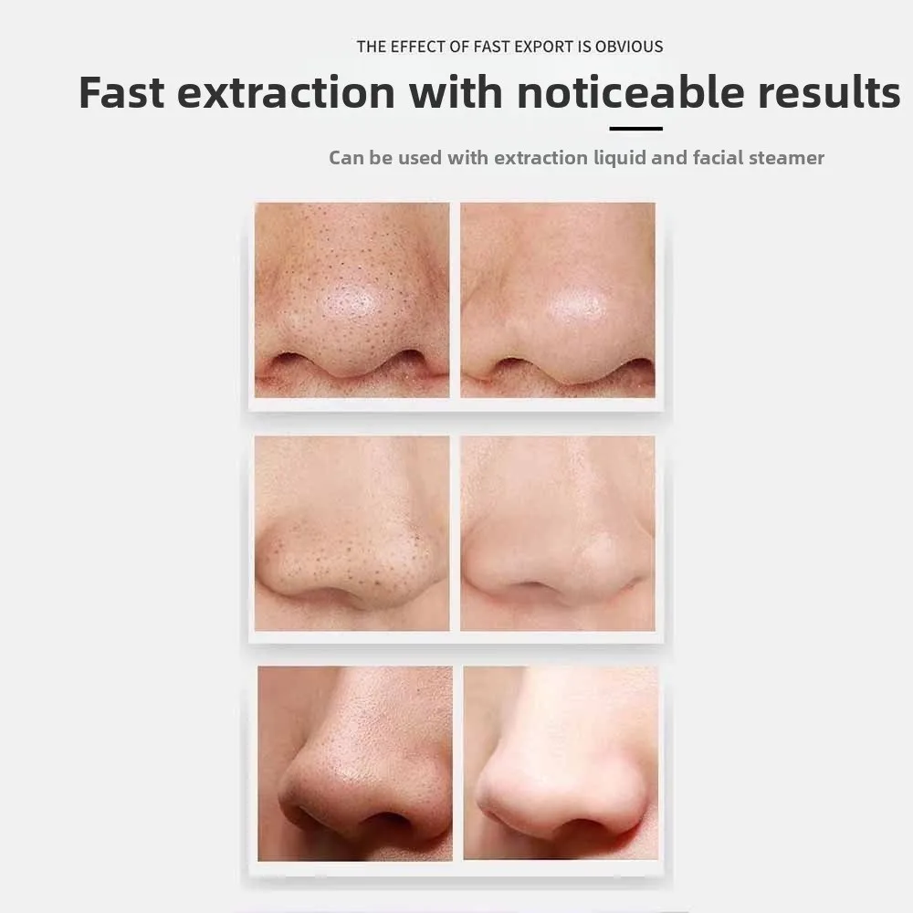 Adjustable Power Electric Pore Cleaning Non Damaging Pores Rechargeable Blackhead Remover Electric Suction Face Cleaning
