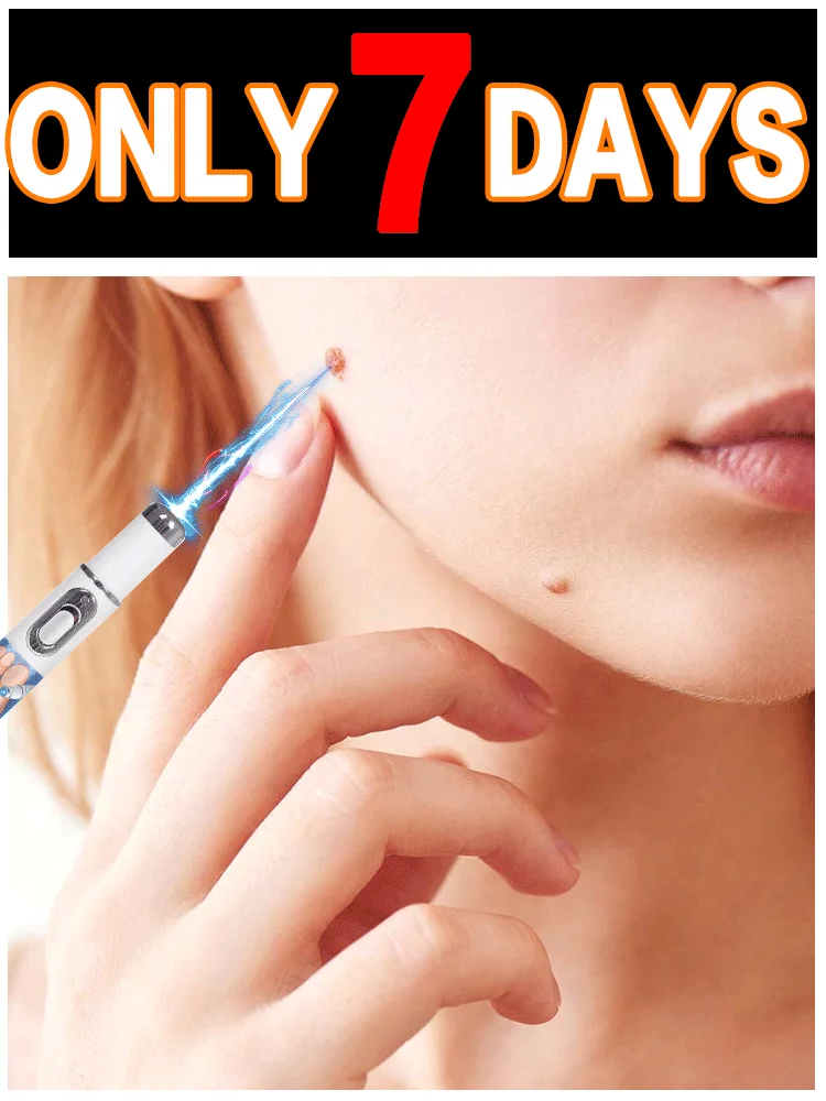 ملحق أداة العناية بالثآليل لعلاج الثآليل، أداة قلم الضوء الأزرق الفعالة