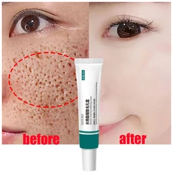 Salicylic Acid Pore Shrinking Cream Large Pores Tightening Repairing Serum Moisturizing Oil Control Korean Skin Care Cosmetic