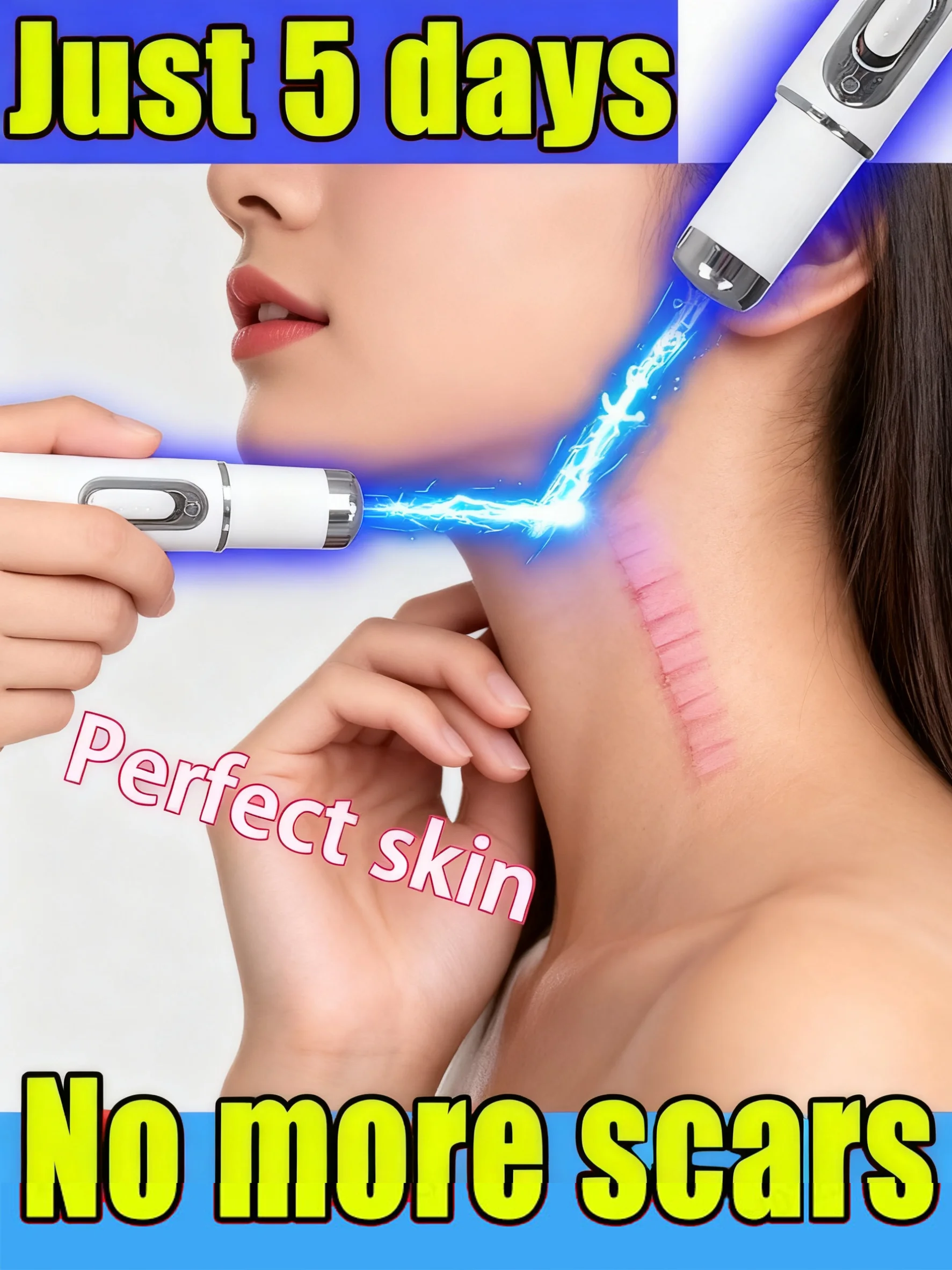 

Лазерная ручка синего света, инструменты для ухода за шрамами, унисекс, горячая распродажа 2025 года