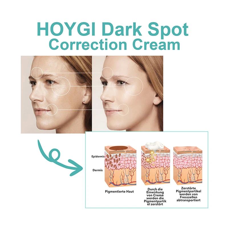 

Dark Spot Correction Cream Niacinamide Dark Spot Remover For Face Moisturizing Lightening Melasma Freckle Sun Spot for Skin Care