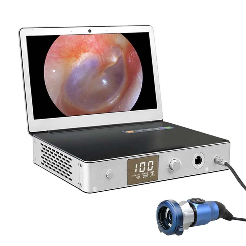 Cheap Medical Endoscopy Camera System USB 3.0 Ear Nose and Throat Endoscopy Camera Full hd Portable ENT Endoscopy Camera