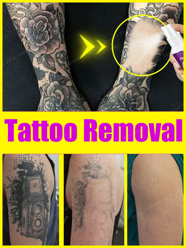 ᵀᵃᵗᵗᵒᵒ ᴿᵉᵐᵒᵛᵃˡ ᔆᵖʳᵃʸ ᔆᵘⁱᵗᵃᵇˡᵉ ᶠᵒʳ ᴸᵃʳᵍᵉ ᵃⁿᵈ ᔆᵐᵃˡˡ ᵀᵃᵗᵗᵒᵒˢ⸴ ᴱᶠᶠᵉᶜᵗⁱᵛᵉ ⁱⁿ ᴿᵉᵐᵒᵛⁱⁿᵍ ᴾᵉʳᵐᵃⁿᵉⁿᵗ ᵀᵃᵗᵗᵒᵒˢ