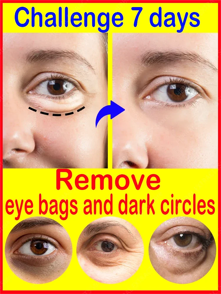 

Eye cream Remove bags Puffiness away work under eyes