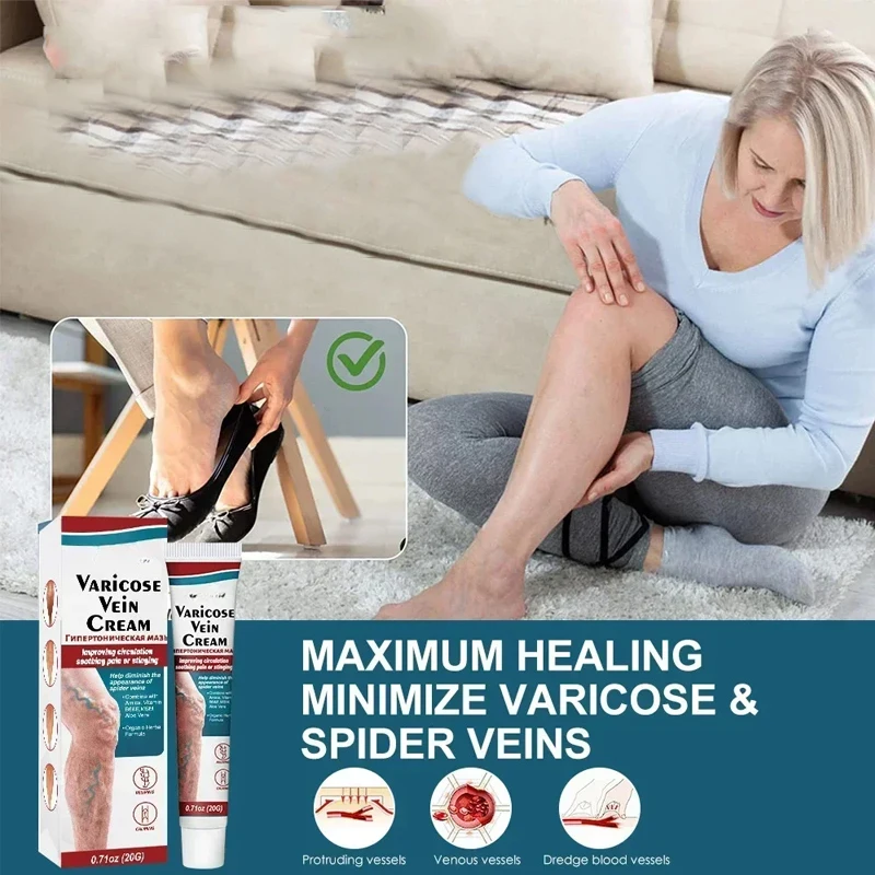 Varicose Veins Pen Improves Moderate Varicose Vein Laser Therapy Relieve Leg Pain Improve Blood Circulation for Men and Women