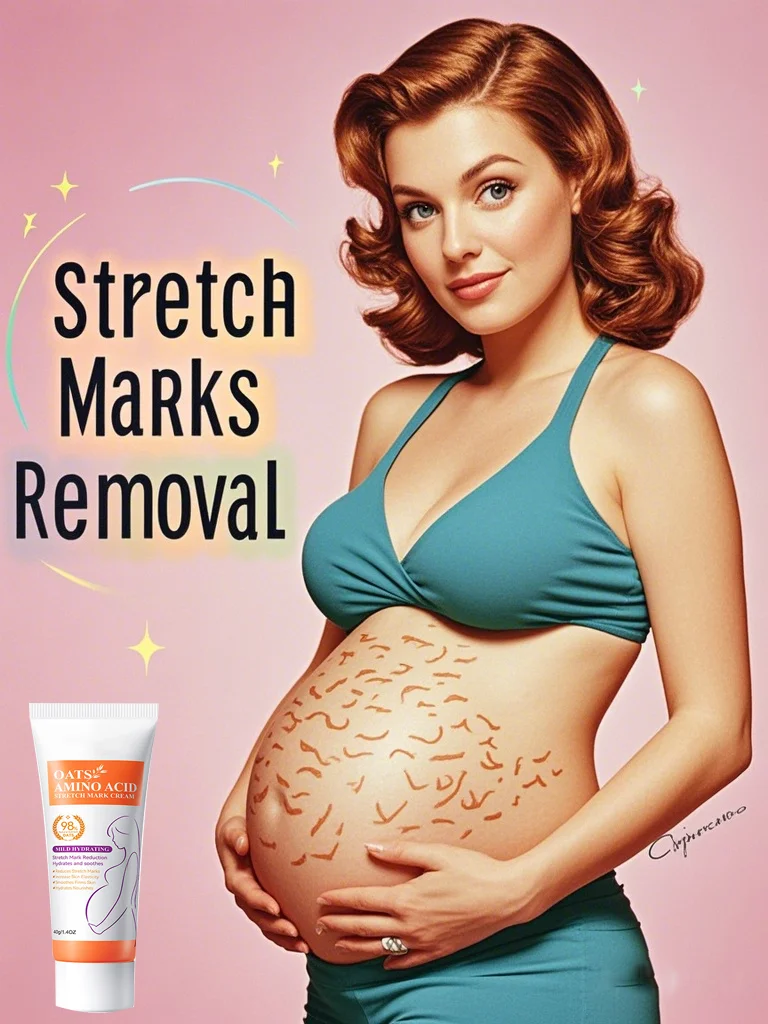 

Cream For Pregnancy Stretch Marks Removal Eliminate Red White Old Stretch Marks 26