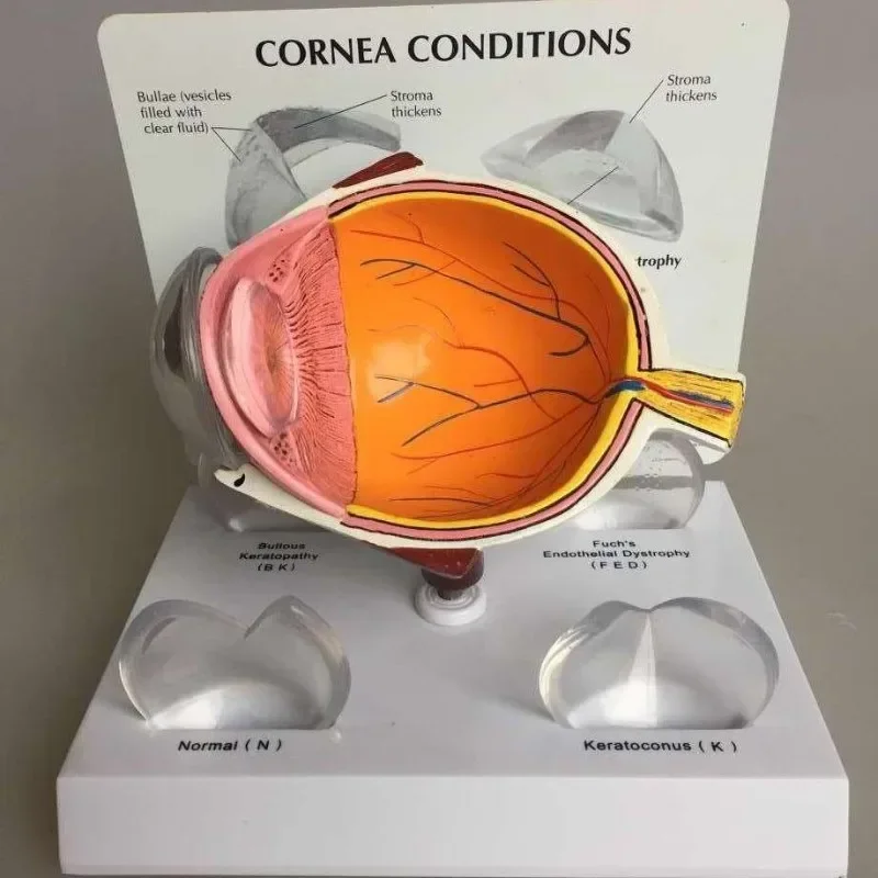 

Corneal Eyeball Model Human Eye Model Medical Teaching Prop Anatomy Medical Teaching Model 12x10x8cm