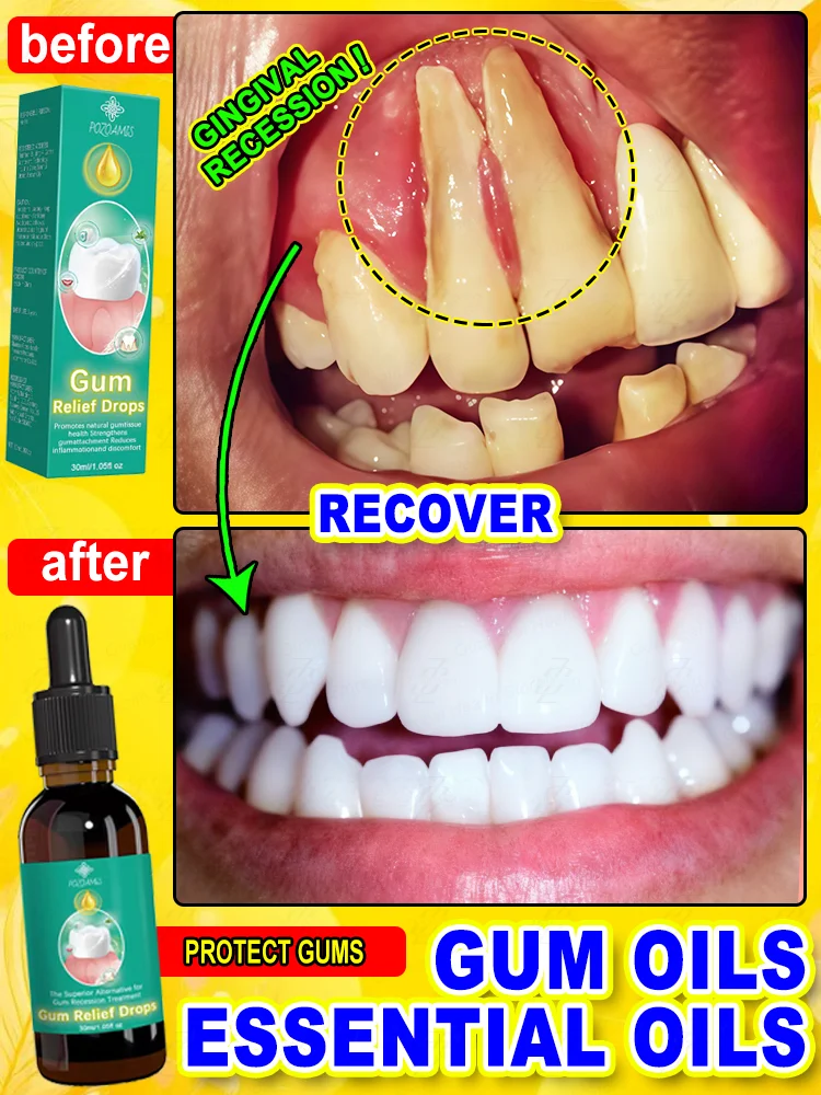

Premium organic gum oil: Effectively soothes sensitivity, reverses gum recession, and strengthens teeth!