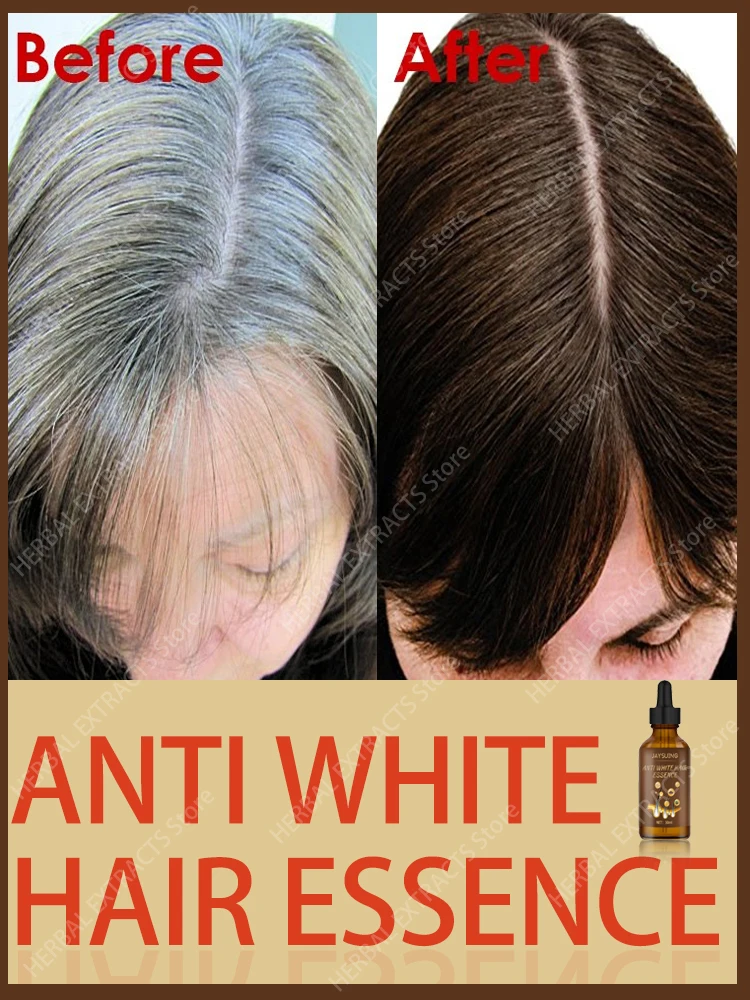 White Hair Treatment Serum Nourishing Scalp Restore Darken Natural Color Repairing Damage Gray Hairs